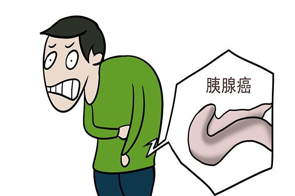 关于胰腺癌你了解多少2