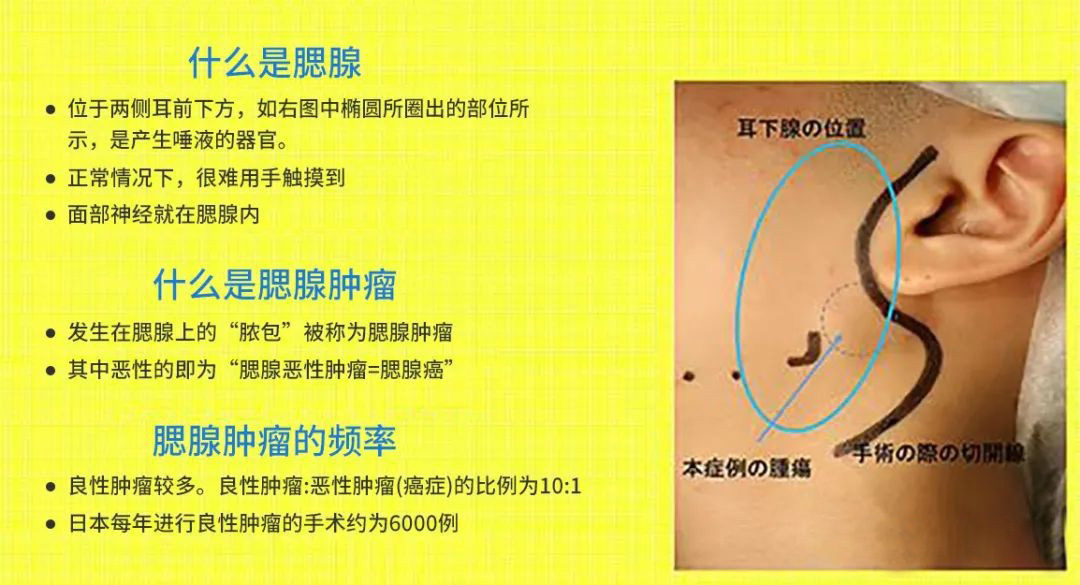 v2-6e5bd772f5138a40fc9e0e373b6671cf_r